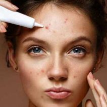 Ways to get rid of hormonal acne